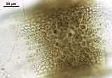 7 – Dettaglio di una zona nodale con file longitudinali di cellule corticali che si dipartono dal margine inferiore